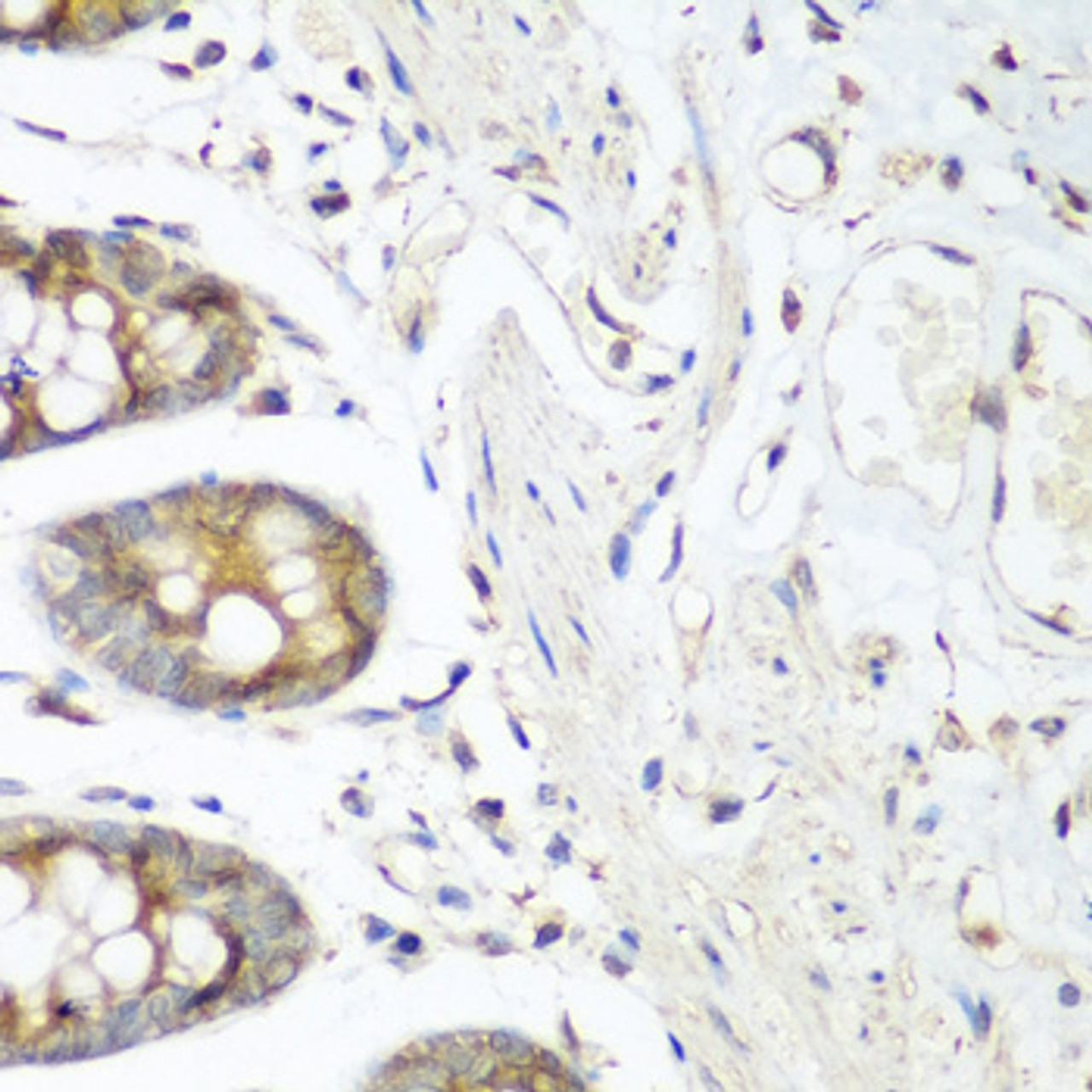 Immunohistochemistry of paraffin-embedded human colon using FLT4 antibody (19-753) at dilution of 1:200 (40x lens) .