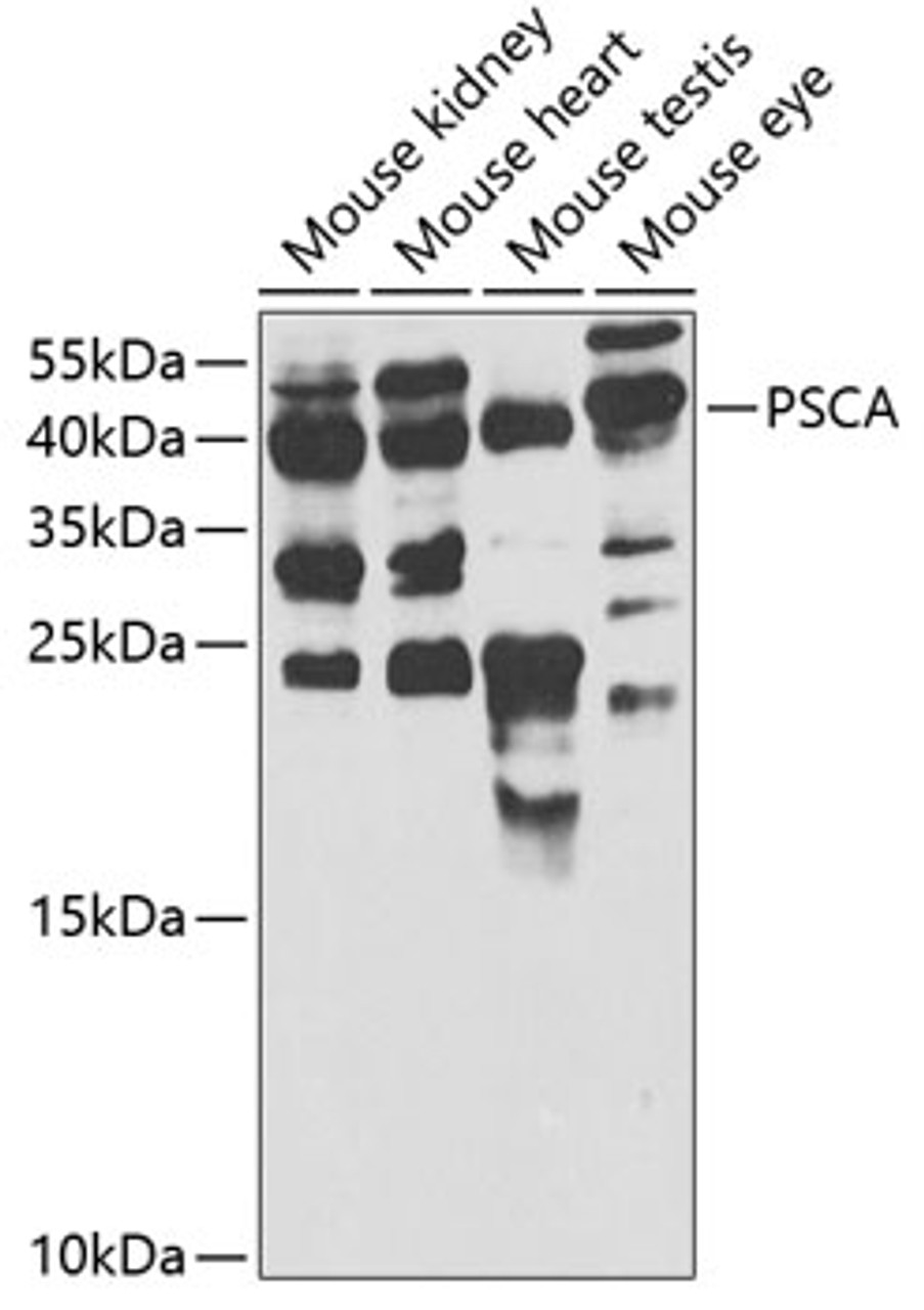 Western blot analysis of extracts of various cell lines, using PSCA antibody (19-756) at 1:1000 dilution.<br/>Secondary antibody: HRP Goat Anti-Rabbit IgG (H+L) at 1:10000 dilution.<br/>Lysates/proteins: 25ug per lane.<br/>Blocking buffer: 3% nonfat dry milk in TBST.<br/>Detection: ECL Enhanced Kit.