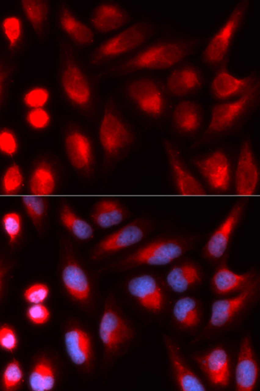 Immunofluorescence analysis of U2OS cells using DCLRE1C antibody (19-757) . Blue: DAPI for nuclear staining.