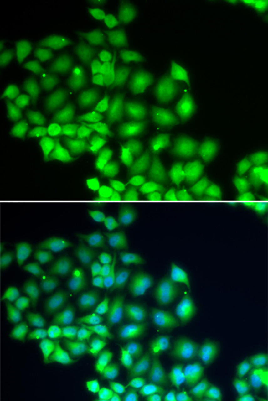 Immunofluorescence analysis of HeLa cells using ERCC2 antibody (19-771) . Blue: DAPI for nuclear staining.