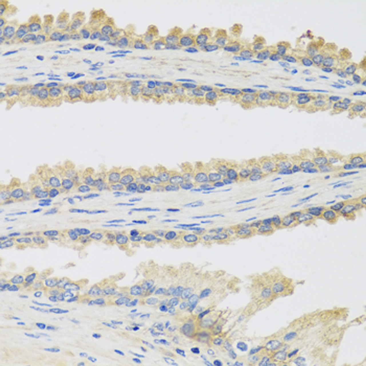 Immunohistochemistry of paraffin-embedded human prostate using INSL3 antibody (19-819) at dilution of 1:100 (40x lens) .
