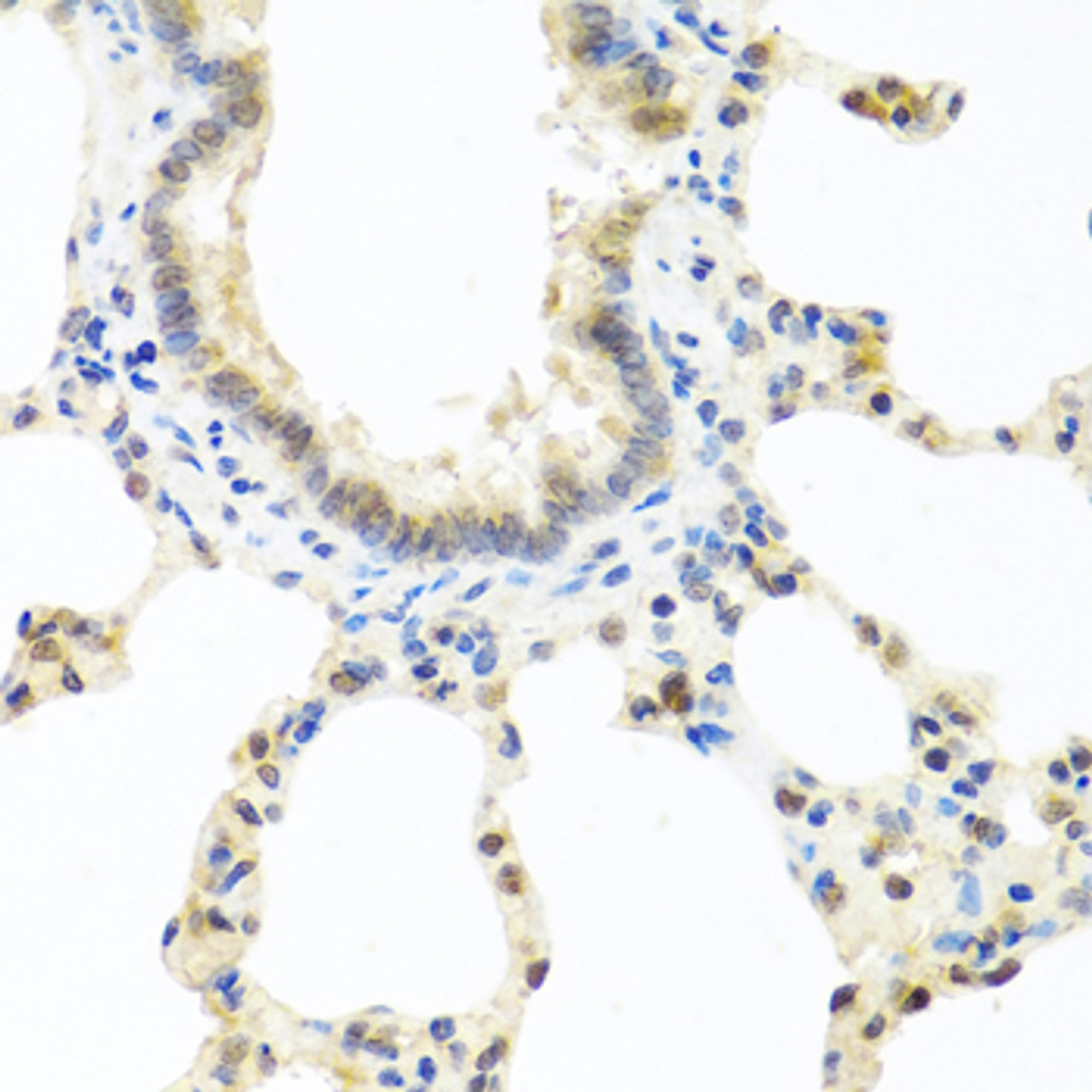 Immunohistochemistry of paraffin-embedded rat lung using DEDD antibody (19-868) at dilution of 1:100 (40x lens) .