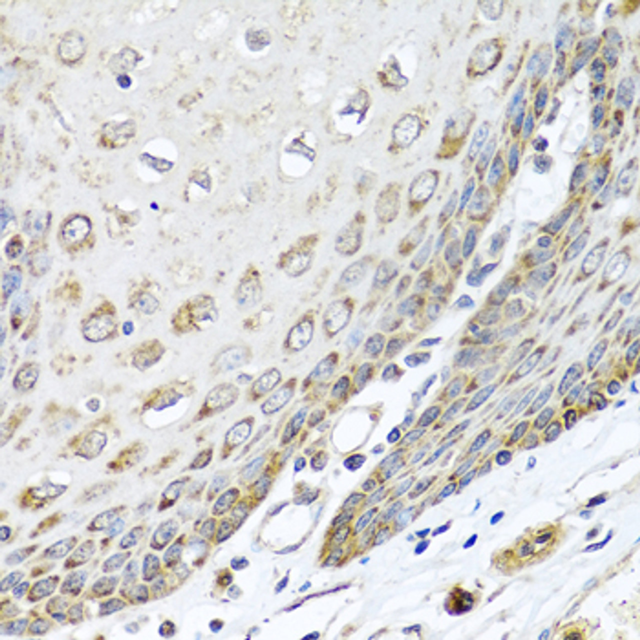 Immunohistochemistry of paraffin-embedded human esophagus using DEDD antibody (19-868) at dilution of 1:100 (40x lens) .