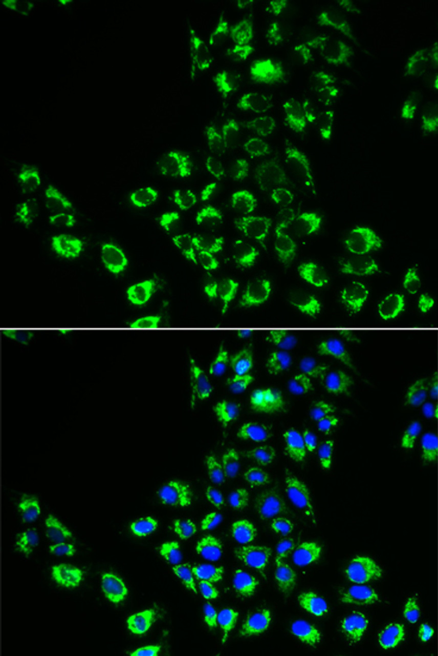 Immunofluorescence analysis of A549 cells using EIF5B antibody (19-922) . Blue: DAPI for nuclear staining.