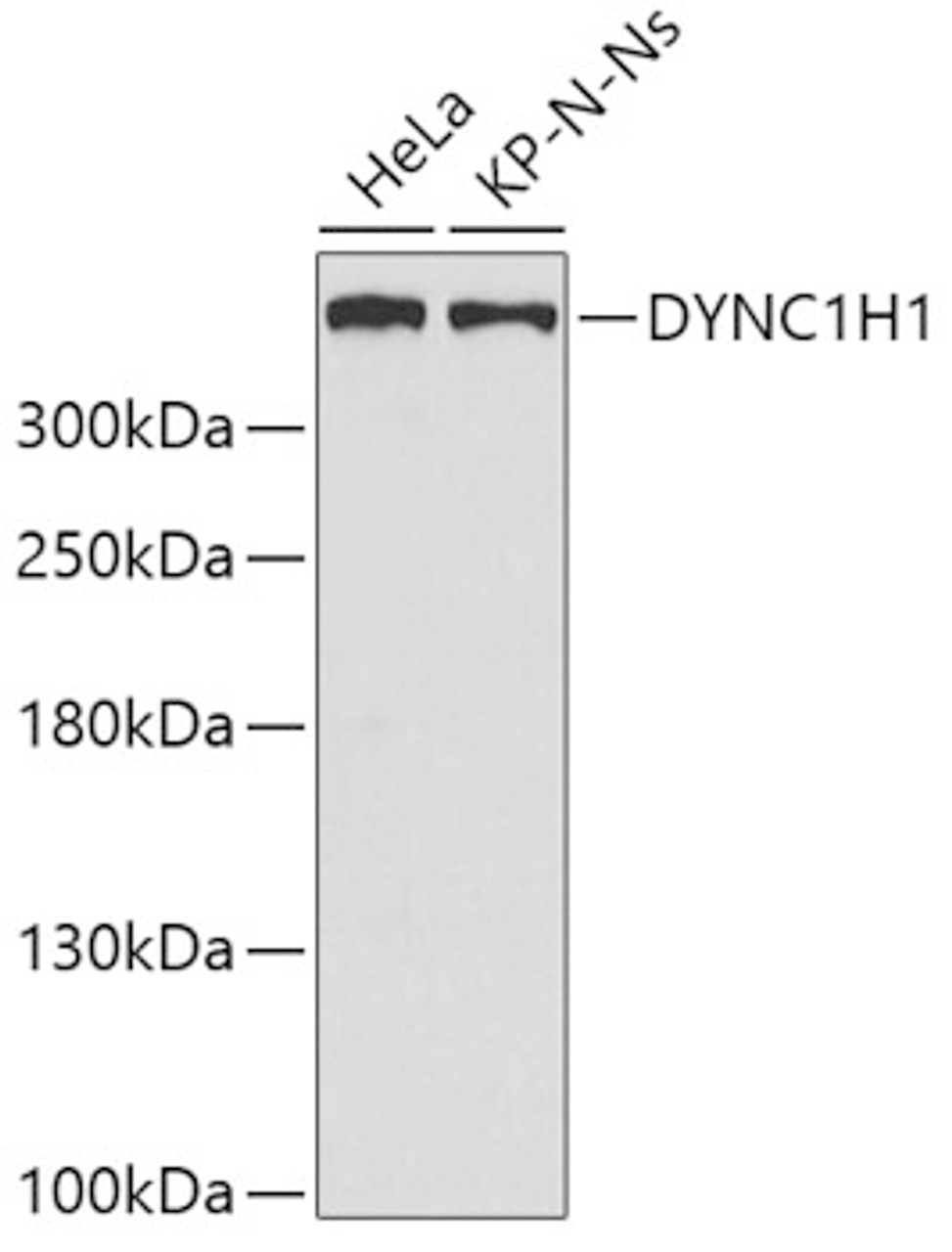 Western blot analysis of extracts of various cell lines, using DYNC1H1 antibody (19-940) .<br/>Secondary antibody: HRP Goat Anti-Rabbit IgG (H+L) at 1:10000 dilution.<br/>Lysates/proteins: 25ug per lane.<br/>Blocking buffer: 3% nonfat dry milk in TBST.
