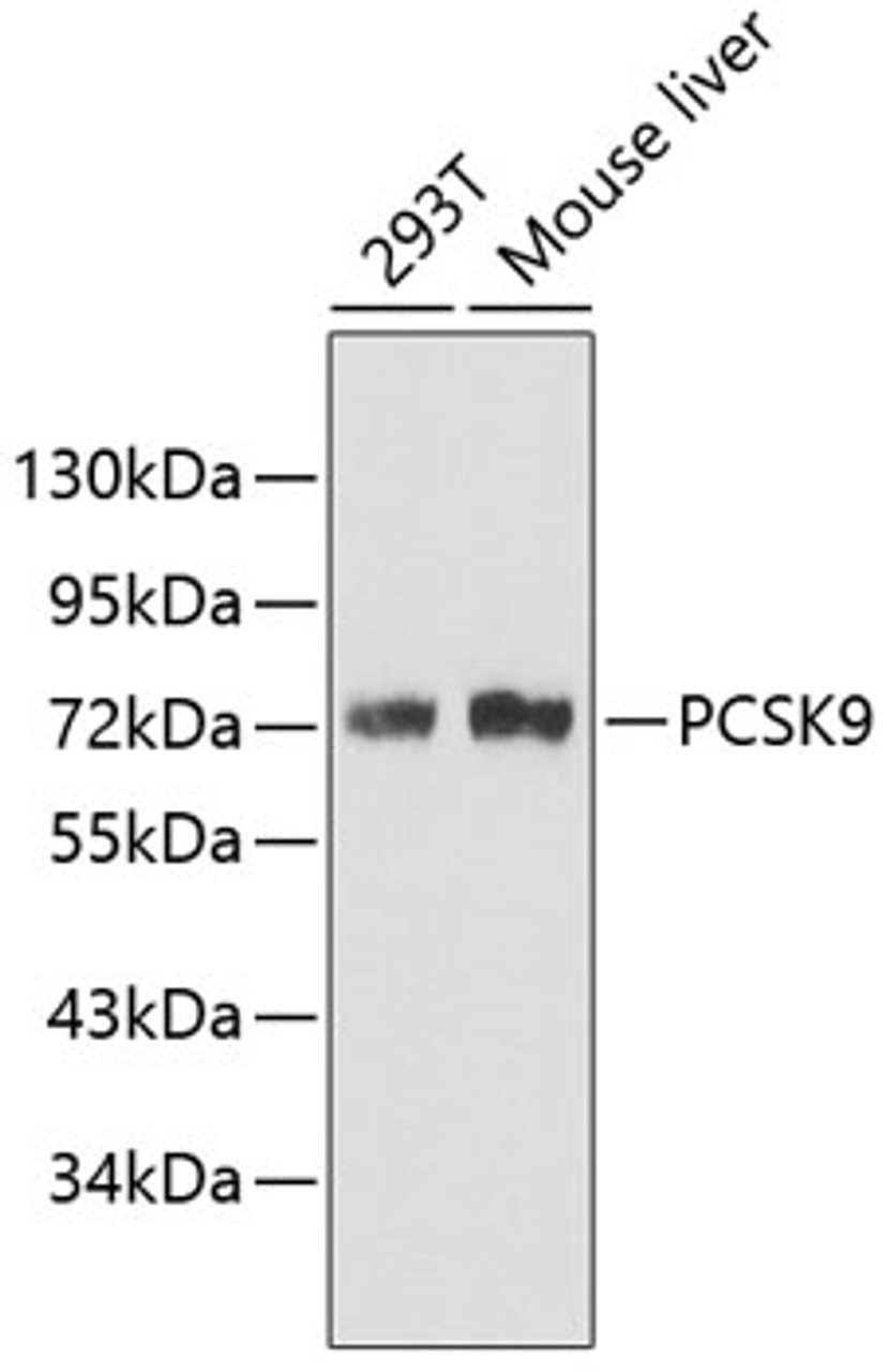 Western blot analysis of extracts of various cell lines, using PCSK9 antibody (19-973) .<br/>Secondary antibody: HRP Goat Anti-Rabbit IgG (H+L) at 1:10000 dilution.<br/>Lysates/proteins: 25ug per lane.<br/>Blocking buffer: 3% nonfat dry milk in TBST.