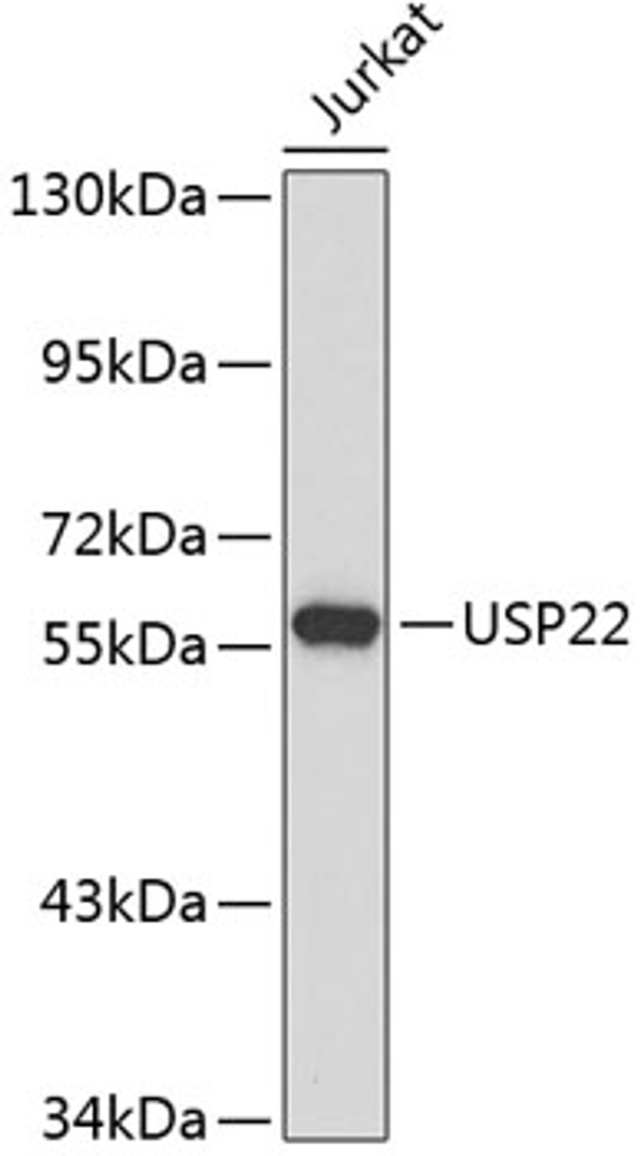 Western blot analysis of extracts of Jurkat cells, using USP22 antibody (22-040) .<br/>Secondary antibody: HRP Goat Anti-Rabbit IgG (H+L) at 1:10000 dilution.<br/>Lysates/proteins: 25ug per lane.<br/>Blocking buffer: 3% nonfat dry milk in TBST.