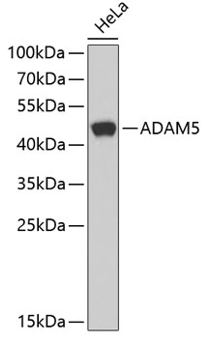 Western blot analysis of extracts of HeLa cells, using ADAM5 antibody (22-049) .<br/>Secondary antibody: HRP Goat Anti-Rabbit IgG (H+L) at 1:10000 dilution.<br/>Lysates/proteins: 25ug per lane.<br/>Blocking buffer: 3% nonfat dry milk in TBST.