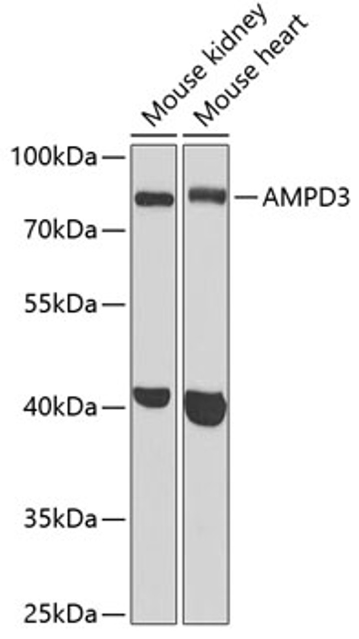 Western blot analysis of extracts of various cell lines, using AMPD3 antibody (22-151) at 1:1000 dilution.<br/>Secondary antibody: HRP Goat Anti-Rabbit IgG (H+L) at 1:10000 dilution.<br/>Lysates/proteins: 25ug per lane.<br/>Blocking buffer: 3% nonfat dry milk in TBST.<br/>Detection: ECL Basic Kit.<br/>Exposure time: 90s.