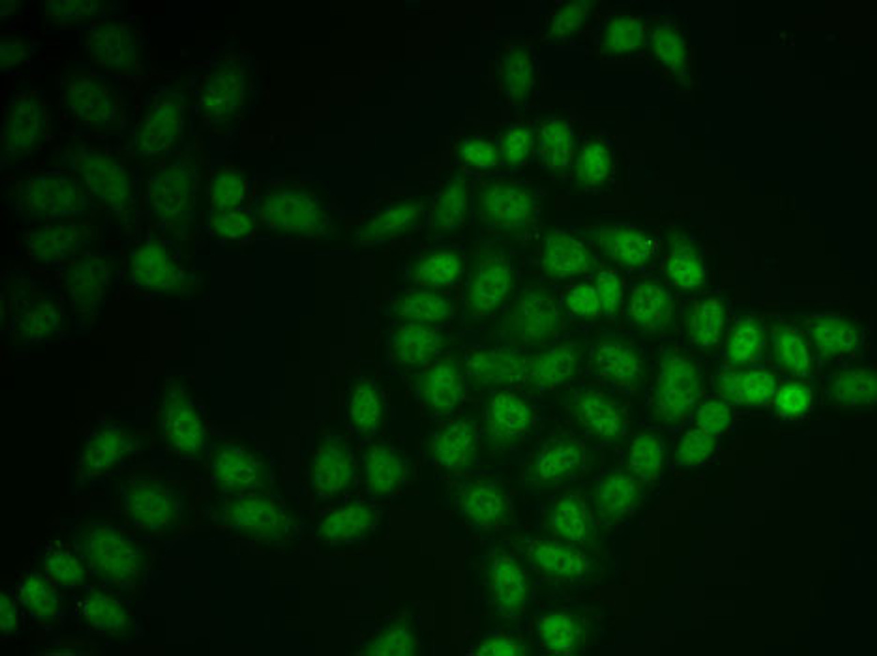Immunofluorescence analysis of U2OS cells using BTG1 antibody (22-155) .