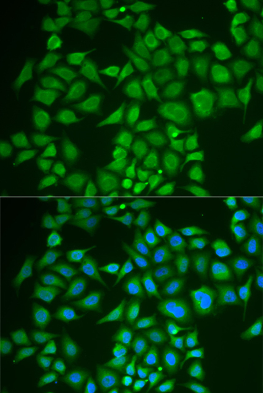 Immunofluorescence analysis of U2OS cells using PNOC antibody (22-185) . Blue: DAPI for nuclear staining.