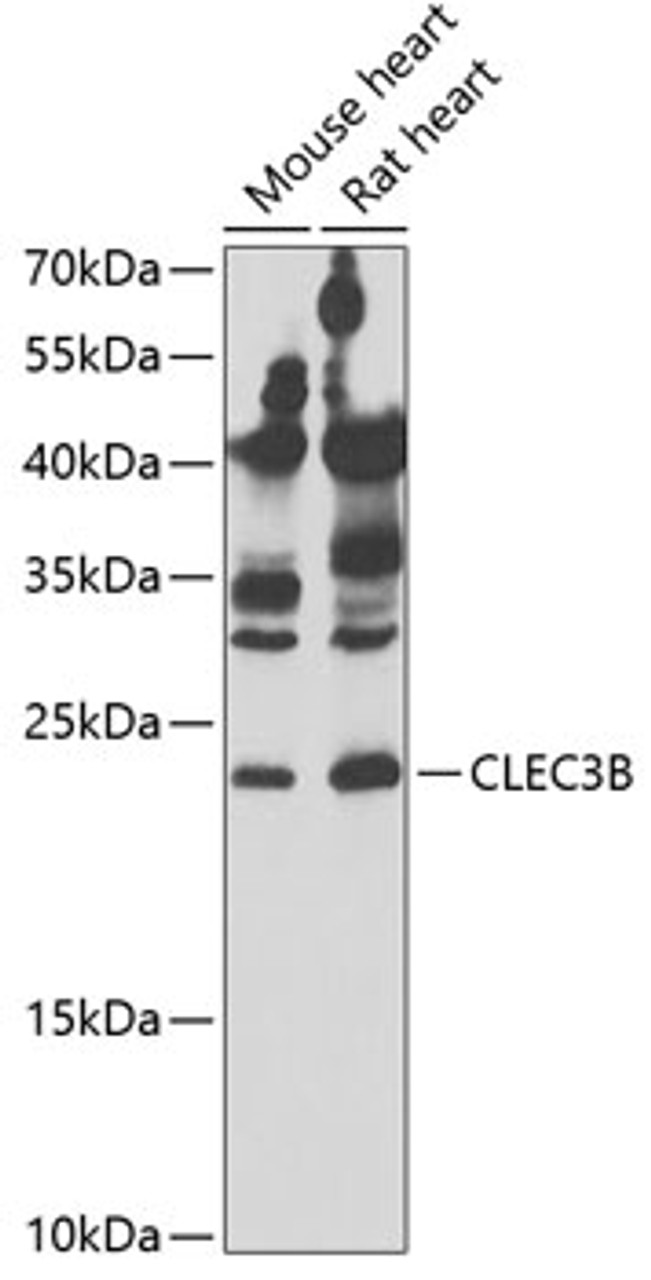 Western blot analysis of extracts of various cell lines, using CLEC3B antibody (22-205) at 1:1000 dilution._Secondary antibody: HRP Goat Anti-Rabbit IgG (H+L) at 1:10000 dilution._Lysates/proteins: 25ug per lane._Blocking buffer: 3% nonfat dry milk in TBST._Detection: ECL Enhanced Kit._Exposure time: 30s.