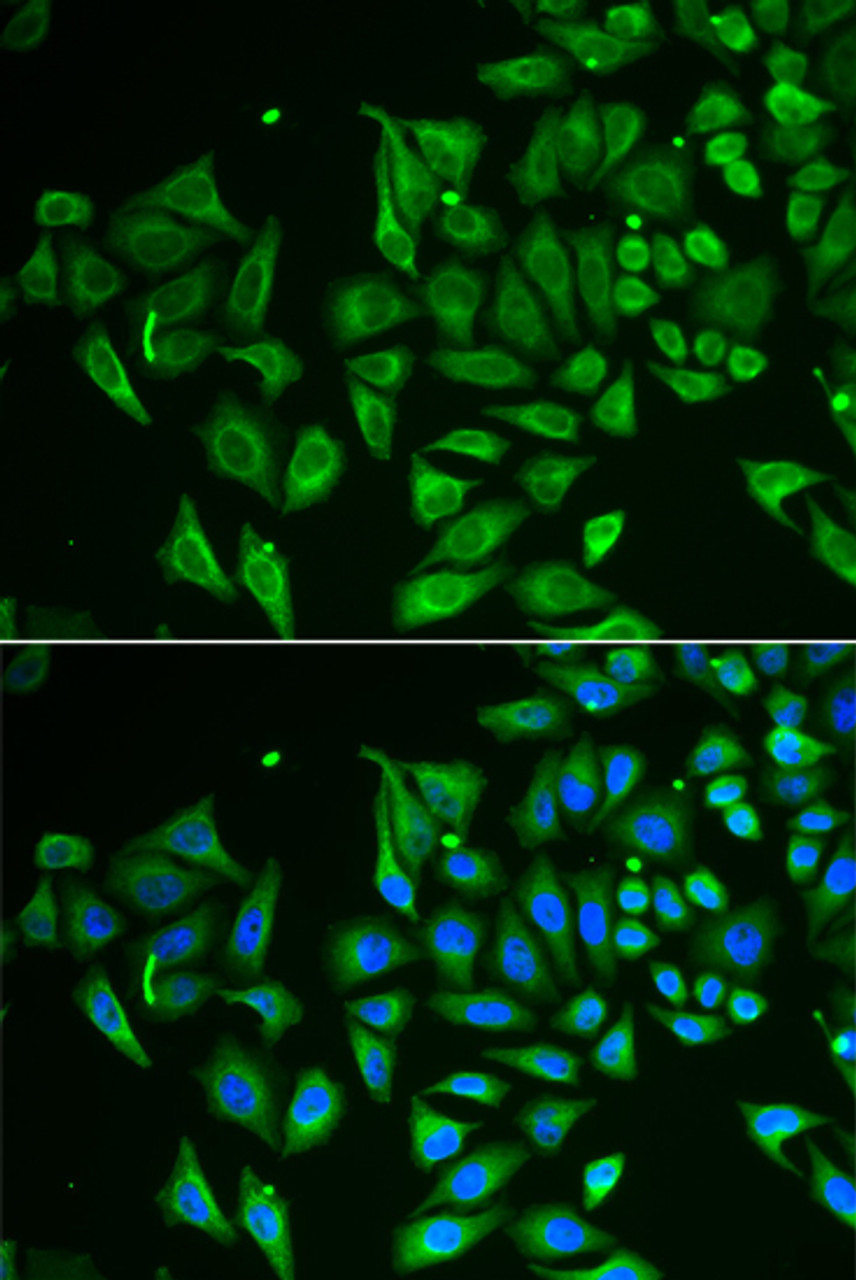 Immunofluorescence analysis of HeLa cells using CLEC3B antibody (22-205) . Blue: DAPI for nuclear staining.