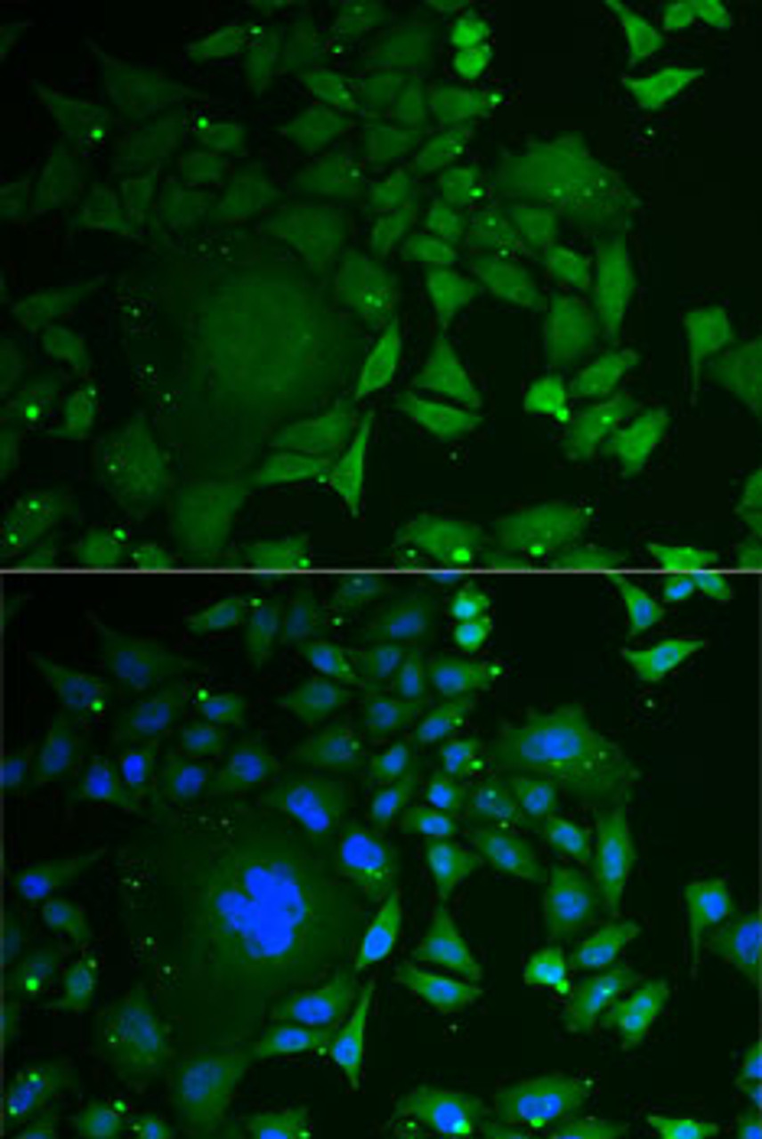 Immunofluorescence analysis of U2OS cells using C1D antibody (22-231) . Blue: DAPI for nuclear staining.