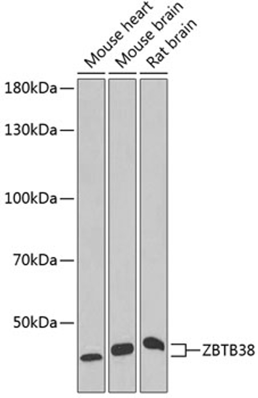 Western blot analysis of extracts of various cell lines, using ZBTB38 antibody (22-266) at 1:1000 dilution.<br/>Secondary antibody: HRP Goat Anti-Rabbit IgG (H+L) at 1:10000 dilution.<br/>Lysates/proteins: 25ug per lane.<br/>Blocking buffer: 3% nonfat dry milk in TBST.<br/>Detection: ECL Enhanced Kit.<br/>Exposure time: 90s.