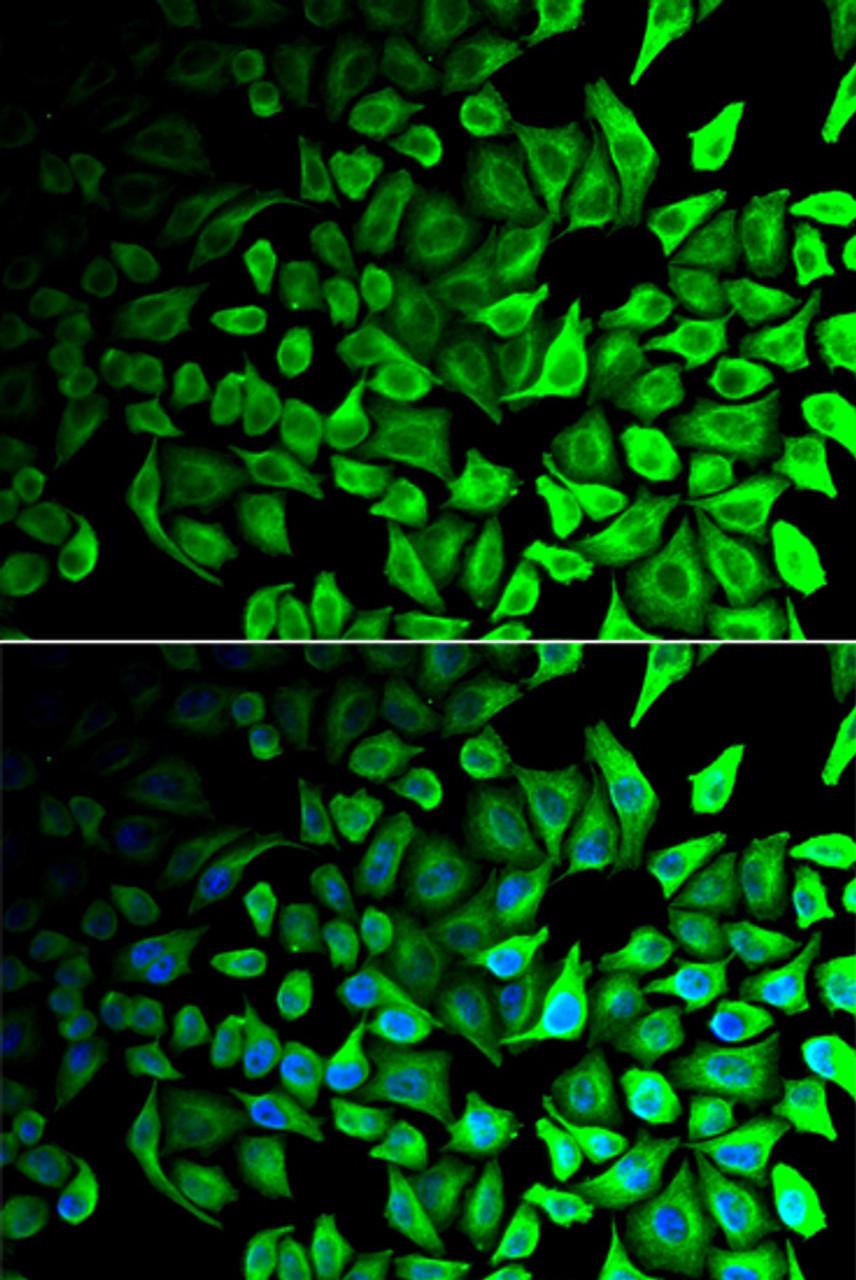 Immunofluorescence analysis of HeLa cells using DPP7 antibody (22-327) . Blue: DAPI for nuclear staining.