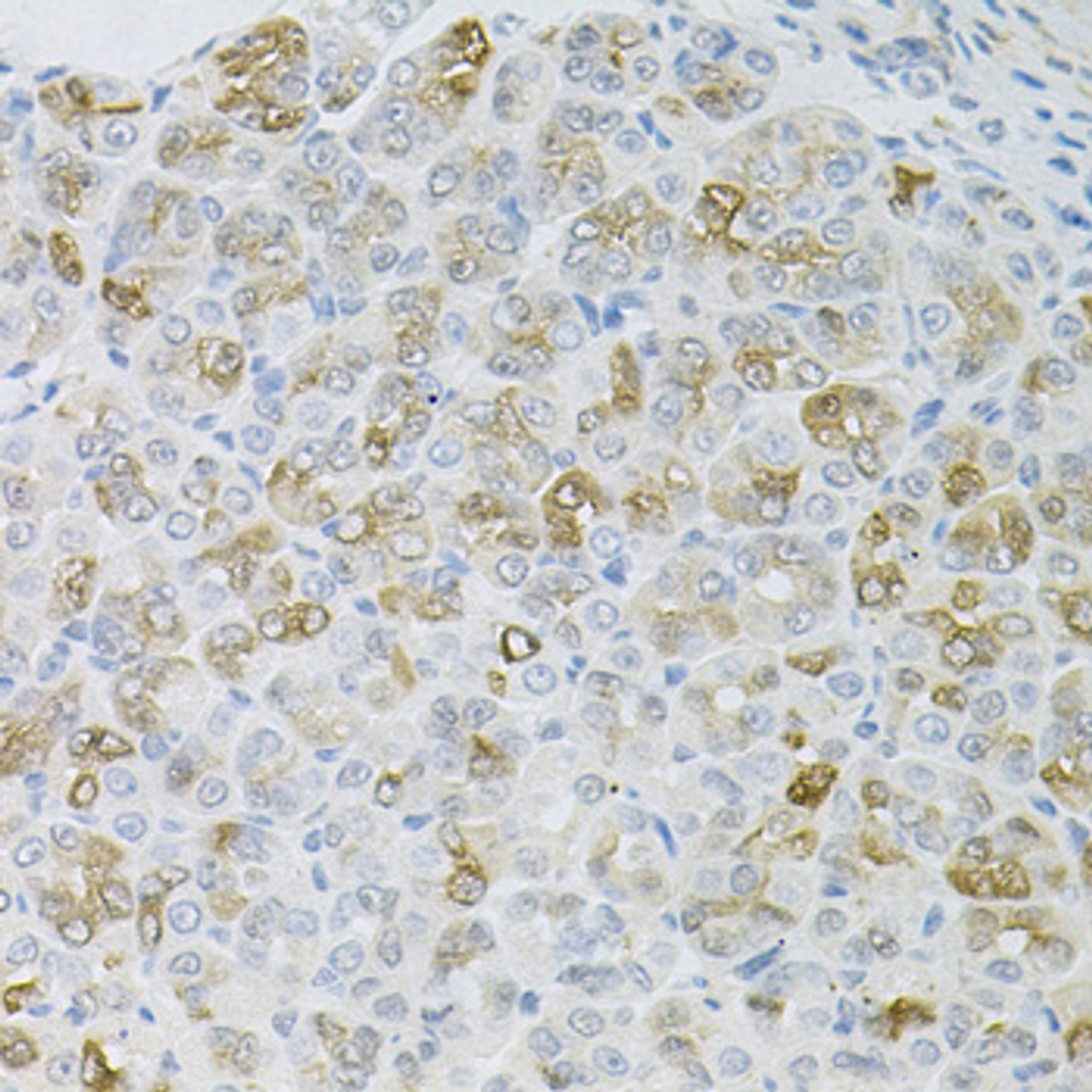 Immunohistochemistry of paraffin-embedded mouse stomach using HPS1 antibody (22-358) at dilution of 1:100 (40x lens) .