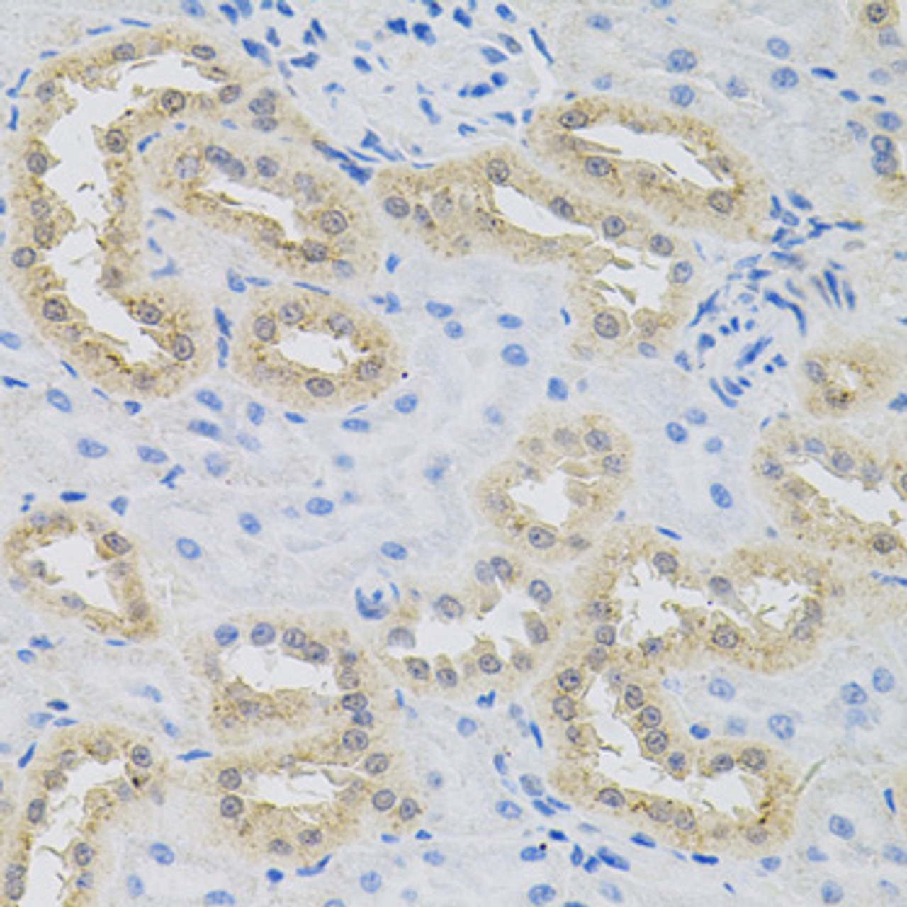 Immunohistochemistry of paraffin-embedded rat kidney using HPS1 antibody (22-358) at dilution of 1:100 (40x lens) .