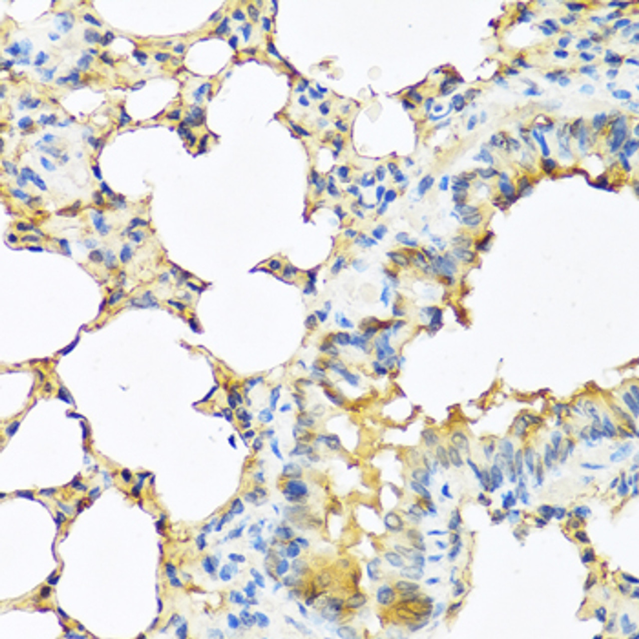 Immunohistochemistry of paraffin-embedded mouse lung using TSHB antibody (22-480) at dilution of 1:100 (40x lens) .