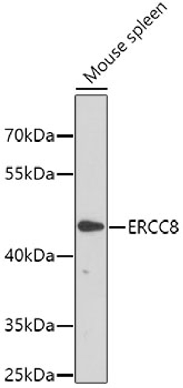 Western blot analysis of extracts of mouse spleen, using ERCC8 antibody (22-495) .<br/>Secondary antibody: HRP Goat Anti-Rabbit IgG (H+L) at 1:10000 dilution.<br/>Lysates/proteins: 25ug per lane.<br/>Blocking buffer: 3% nonfat dry milk in TBST.