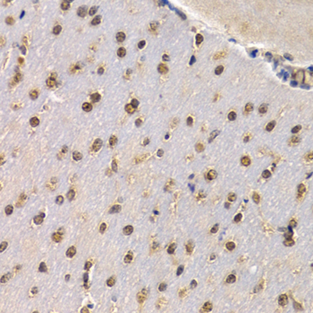 Immunohistochemistry of paraffin-embedded mouse brain using RAD1 antibody (22-505) at dilution of 1:200 (40x lens) .