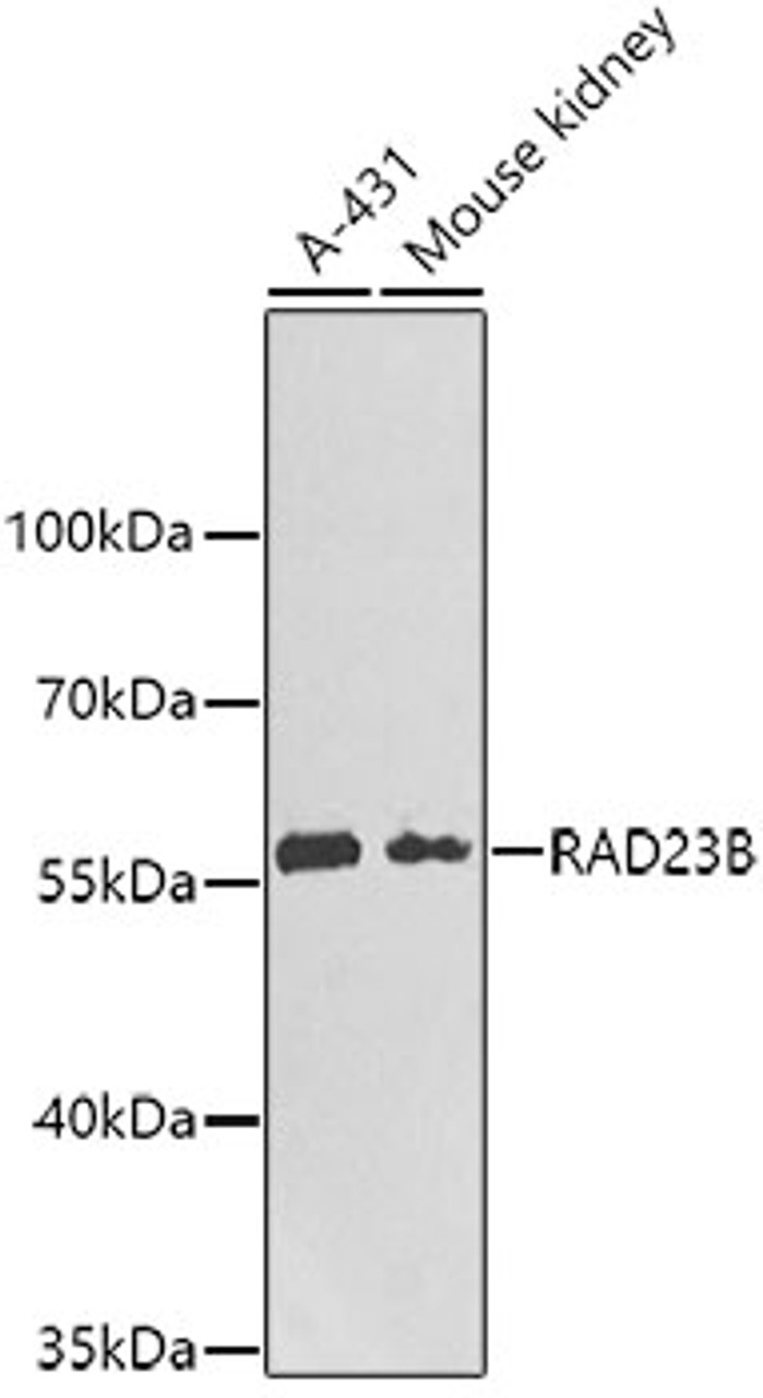 Western blot analysis of extracts of various cell lines, using RAD23B antibody (22-506) .<br/>Secondary antibody: HRP Goat Anti-Mouse IgG (H+L) (AS003) at 1:10000 dilution.<br/>Lysates/proteins: 25ug per lane.<br/>Blocking buffer: 3% nonfat dry milk in TBST.