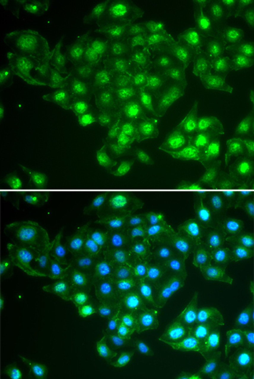 Immunofluorescence analysis of HeLa cells using ABCA3 antibody (22-511) . Blue: DAPI for nuclear staining.