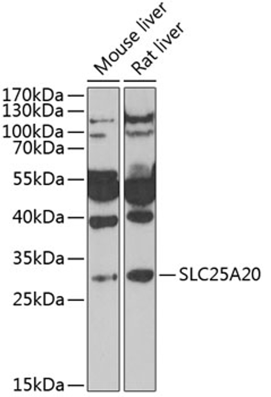 Western blot analysis of extracts of various cell lines, using SLC25A20 antibody (22-526) at 1:1000 dilution.<br/>Secondary antibody: HRP Goat Anti-Rabbit IgG (H+L) at 1:10000 dilution.<br/>Lysates/proteins: 25ug per lane.<br/>Blocking buffer: 3% nonfat dry milk in TBST.<br/>Detection: ECL Basic Kit.<br/>Exposure time: 90s.