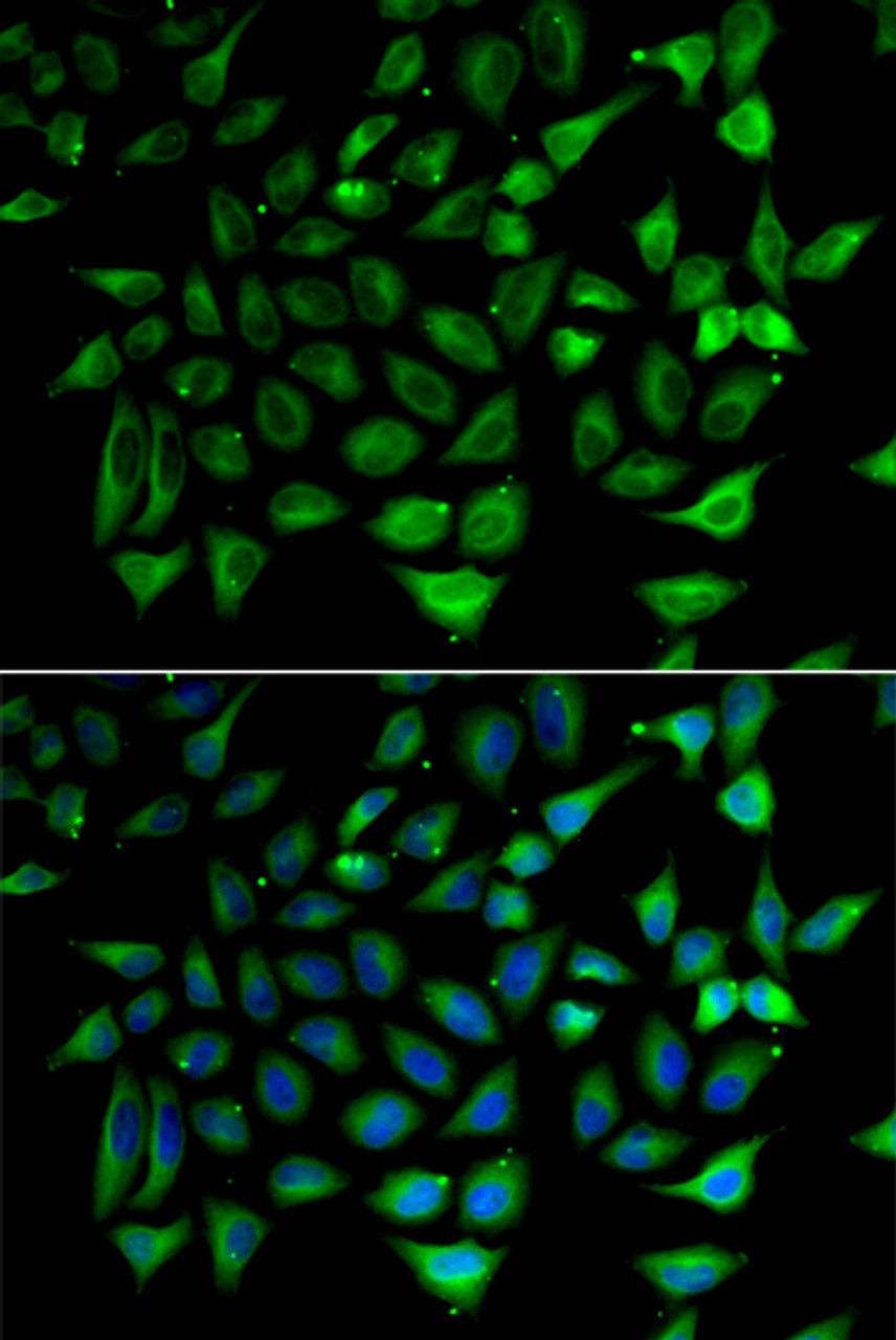 Immunofluorescence analysis of HeLa cells using SLC25A20 antibody (22-526) . Blue: DAPI for nuclear staining.