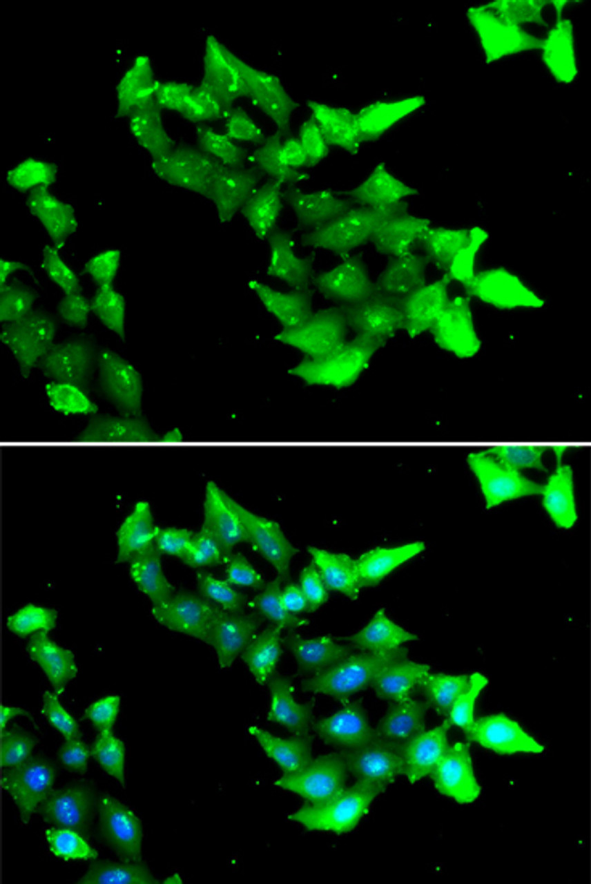 Immunofluorescence analysis of HeLa cells using KRIT1 antibody (22-527) . Blue: DAPI for nuclear staining.