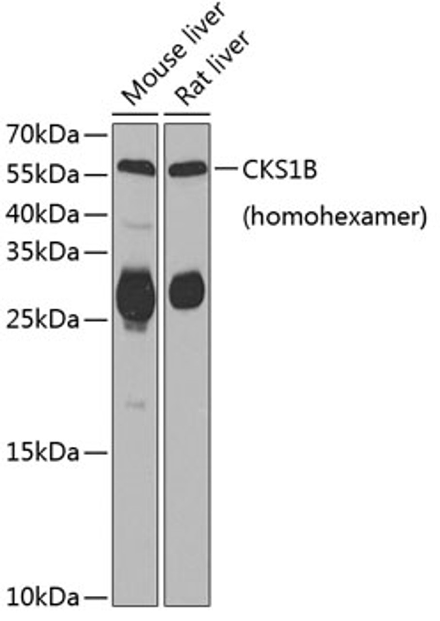 Western blot analysis of extracts of various cell lines, using CKS1B antibody (22-530) at 1:1000 dilution._Secondary antibody: HRP Goat Anti-Rabbit IgG (H+L) at 1:10000 dilution._Lysates/proteins: 25ug per lane._Blocking buffer: 3% nonfat dry milk in TBST._Detection: ECL Enhanced Kit._Exposure time: 30s.