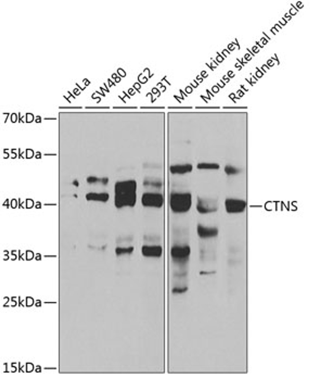 Western blot analysis of extracts of various cell lines, using CTNS antibody (22-534) at 1:1000 dilution.<br/>Secondary antibody: HRP Goat Anti-Rabbit IgG (H+L) at 1:10000 dilution.<br/>Lysates/proteins: 25ug per lane.<br/>Blocking buffer: 3% nonfat dry milk in TBST.<br/>Detection: ECL Basic Kit.<br/>Exposure time: 3s.