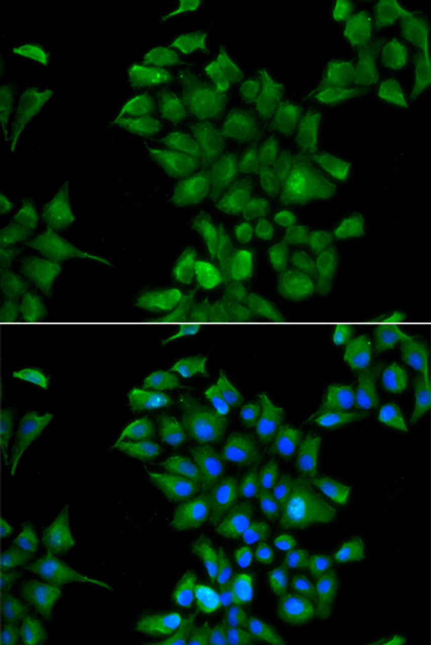 Immunofluorescence analysis of HeLa cells using CTNS antibody (22-534) . Blue: DAPI for nuclear staining.