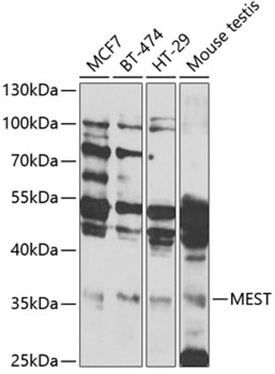 Western blot analysis of extracts of various cell lines, using MEST antibody (22-564) at 1:1000 dilution.<br/>Secondary antibody: HRP Goat Anti-Rabbit IgG (H+L) at 1:10000 dilution.<br/>Lysates/proteins: 25ug per lane.<br/>Blocking buffer: 3% nonfat dry milk in TBST.<br/>Detection: ECL Basic Kit.<br/>Exposure time: 10s.