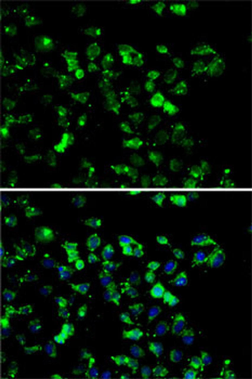 Immunofluorescence analysis of A-549 cells using RBBP6 antibody (22-593) . Blue: DAPI for nuclear staining.
