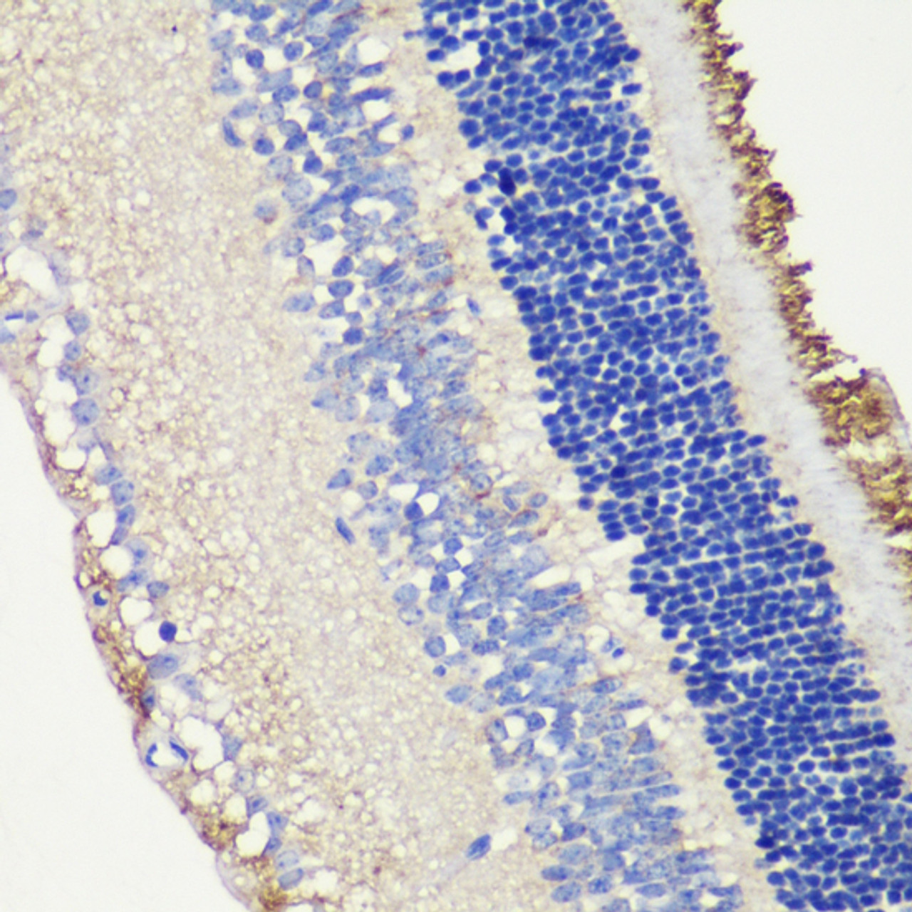 Immunohistochemistry of paraffin-embedded mouse retina using ROM1 antibody (22-596) at dilution of 1:200 (40x lens) .