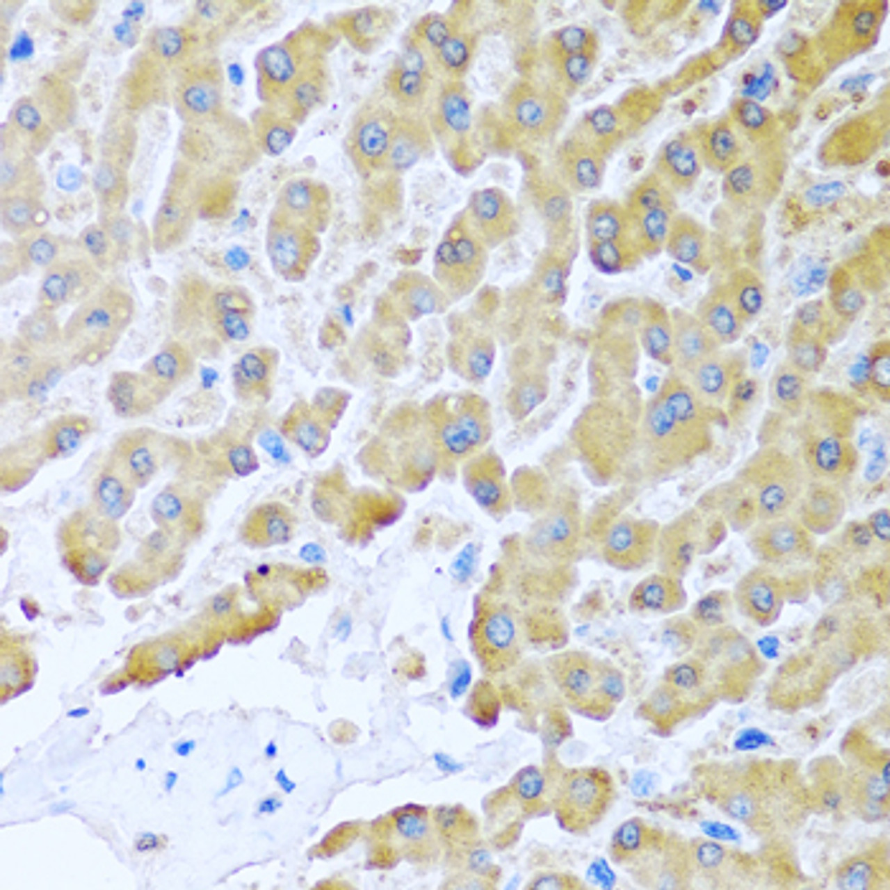 Immunohistochemistry of paraffin-embedded human liver using CCL8 antibody (22-600) at dilution of 1:100 (40x lens) .