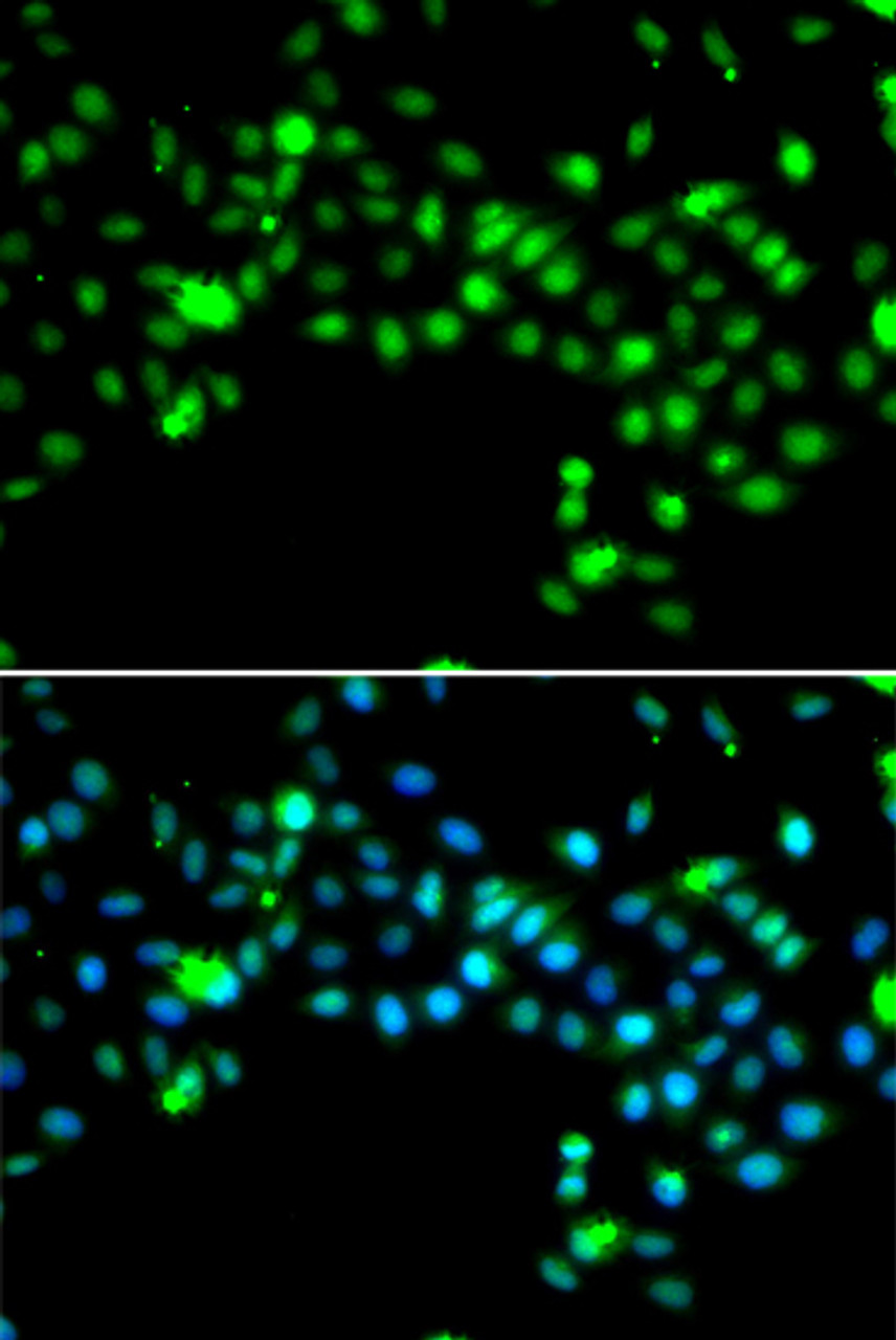 Immunofluorescence analysis of MCF-7 cells using SRSF4 antibody (22-601) . Blue: DAPI for nuclear staining.