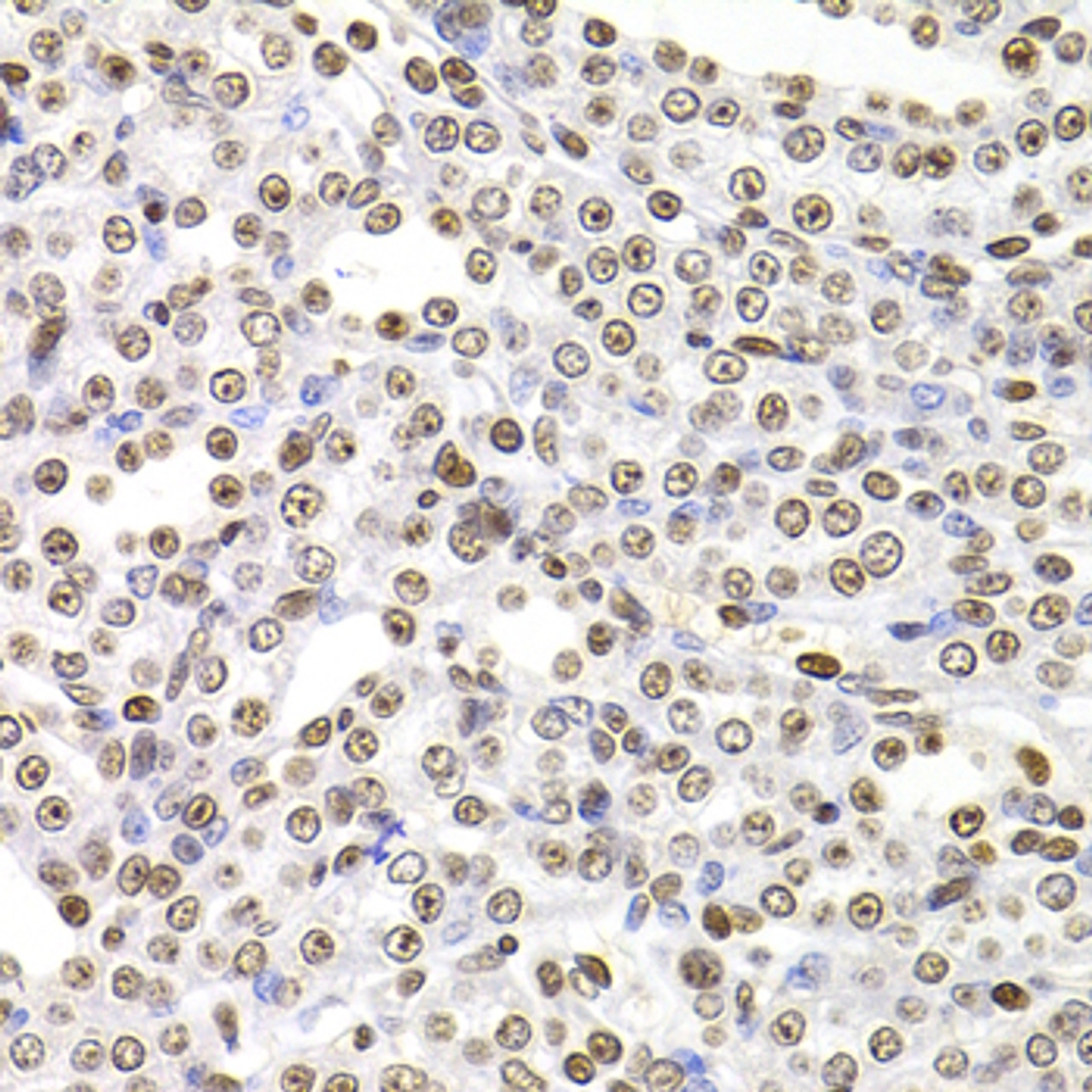 Immunohistochemistry of paraffin-embedded rat kidney using SOX5 antibody (22-607) at dilution of 1:100 (40x lens) .