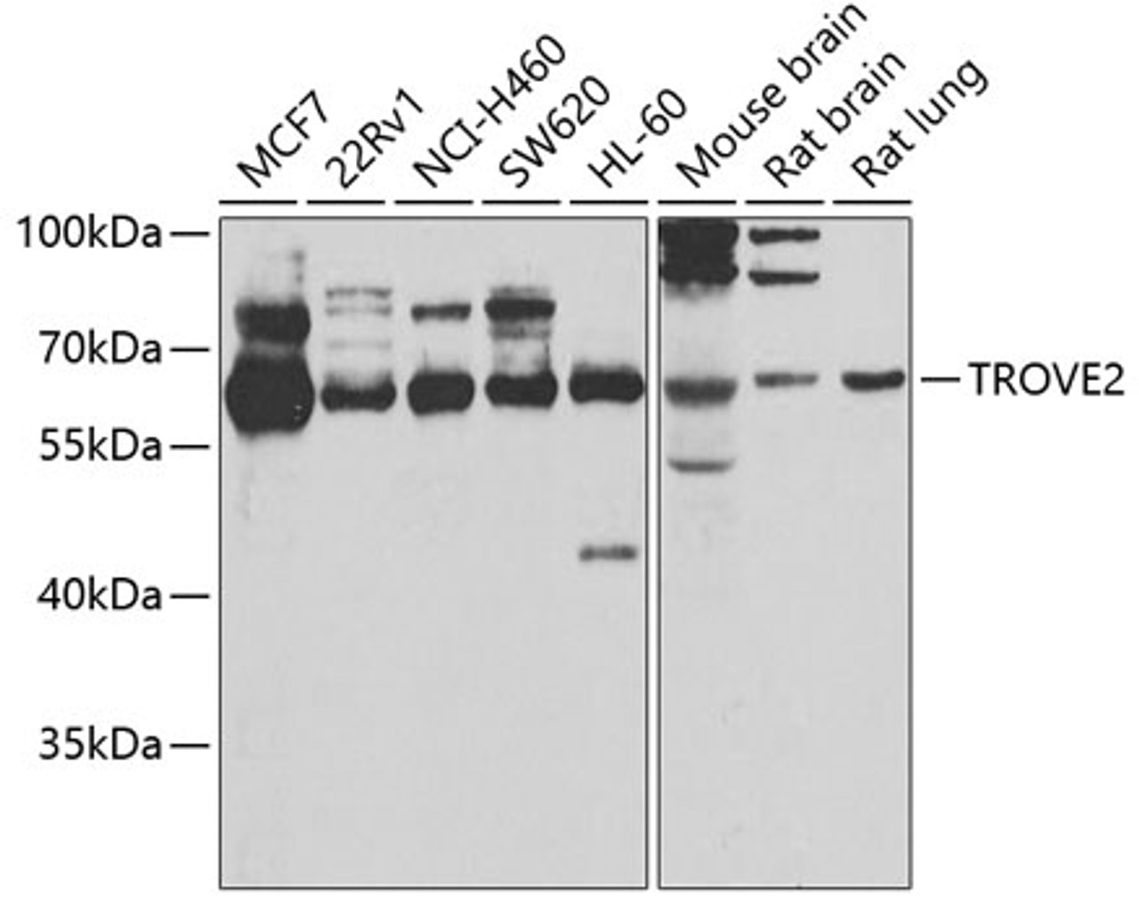 Western blot analysis of extracts of various cell lines, using TROVE2 antibody (22-608) at 1:1000 dilution.<br/>Secondary antibody: HRP Goat Anti-Rabbit IgG (H+L) at 1:10000 dilution.<br/>Lysates/proteins: 25ug per lane.<br/>Blocking buffer: 3% nonfat dry milk in TBST.<br/>Detection: ECL Basic Kit.<br/>Exposure time: 10s.