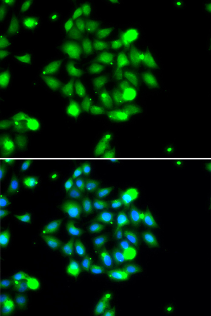 Immunofluorescence analysis of U2OS cells using UBE2G1 antibody (22-618) . Blue: DAPI for nuclear staining.