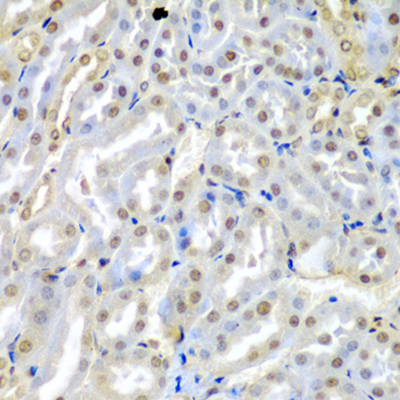 Immunohistochemistry of paraffin-embedded mouse kidney using TUSC2 antibody (22-679) at dilution of 1:200 (40x lens) .