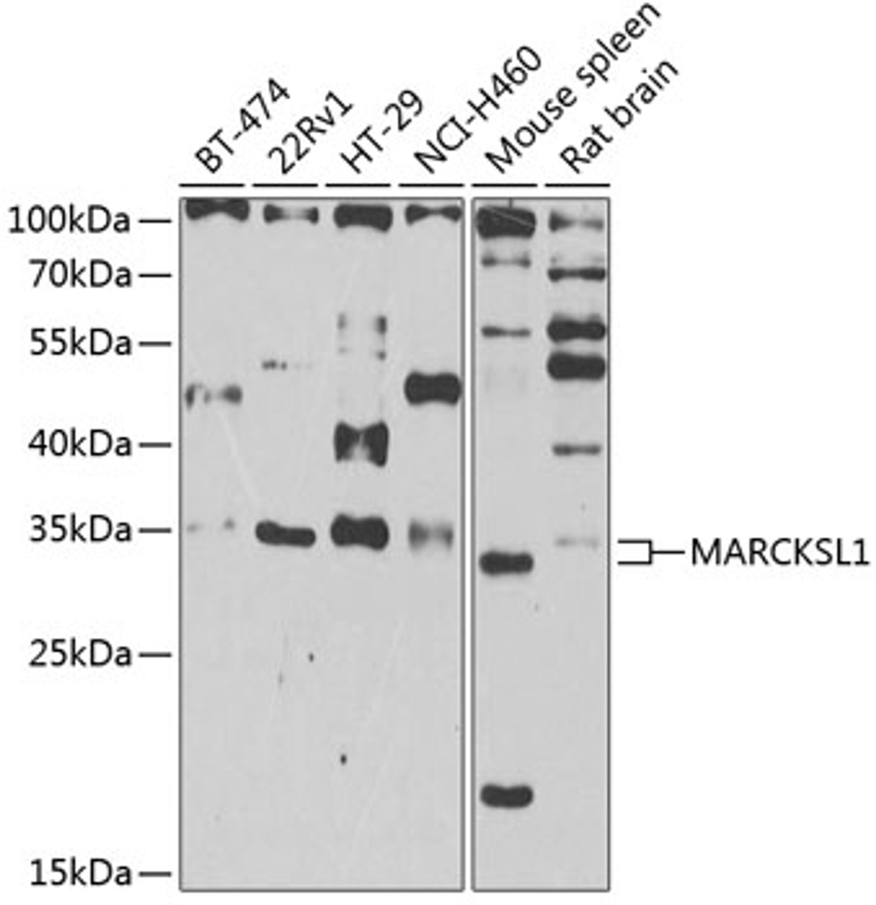 Western blot analysis of extracts of various cell lines, using MARCKSL1 antibody (22-727) at 1:1000 dilution.<br/>Secondary antibody: HRP Goat Anti-Rabbit IgG (H+L) at 1:10000 dilution.<br/>Lysates/proteins: 25ug per lane.<br/>Blocking buffer: 3% nonfat dry milk in TBST.<br/>Detection: ECL Enhanced Kit.<br/>Exposure time: 90s.