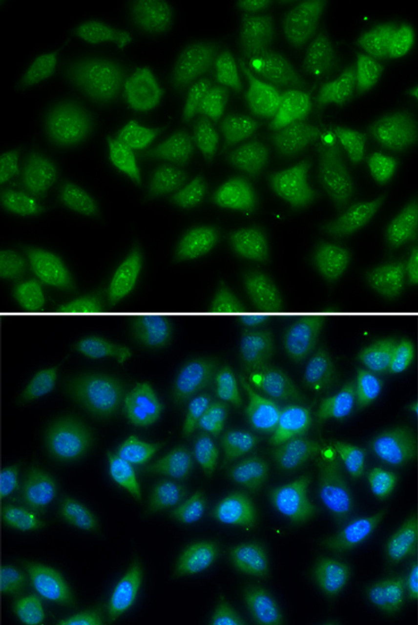 Immunofluorescence analysis of A549 cells using LELP1 antibody (22-740) . Blue: DAPI for nuclear staining.