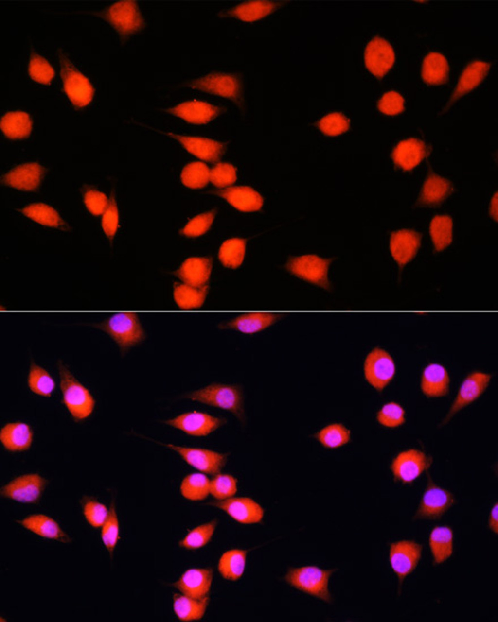 Immunofluorescence analysis of L929 cells using COMMD1 antibody (22-741) at dilution of 1:100. Blue: DAPI for nuclear staining.