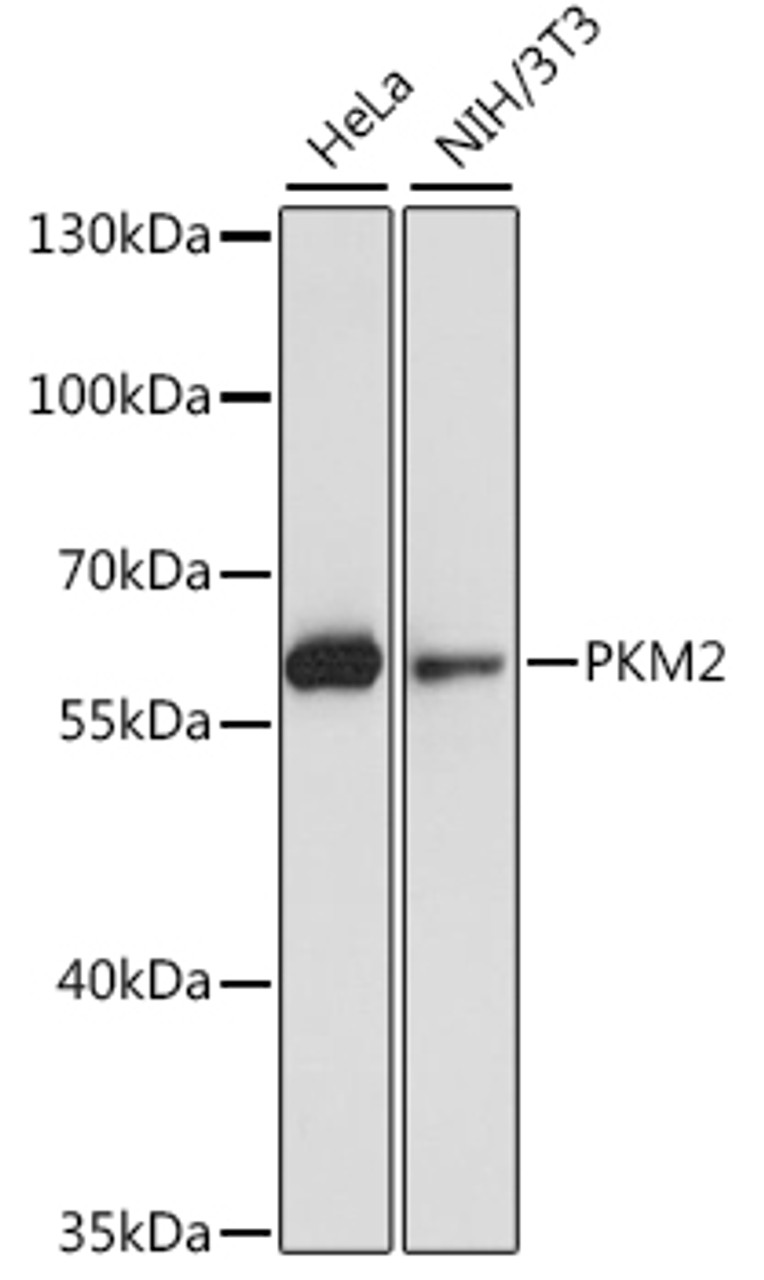 Western blot analysis of extracts of various cell lines, using PKM antibody (22-748) .<br/>Secondary antibody: HRP Goat Anti-Rabbit IgG (H+L) at 1:10000 dilution.<br/>Lysates/proteins: 25ug per lane.<br/>Blocking buffer: 3% nonfat dry milk in TBST.