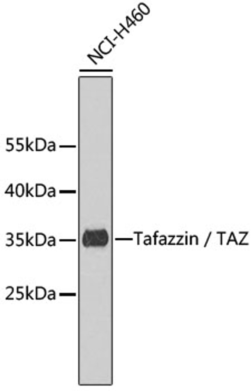 Western blot analysis of extracts of NCI-H460 cells, using Tafazzin / TAZ antibody (22-750) .<br/>Secondary antibody: HRP Goat Anti-Rabbit IgG (H+L) at 1:10000 dilution.<br/>Lysates/proteins: 25ug per lane.<br/>Blocking buffer: 3% nonfat dry milk in TBST.