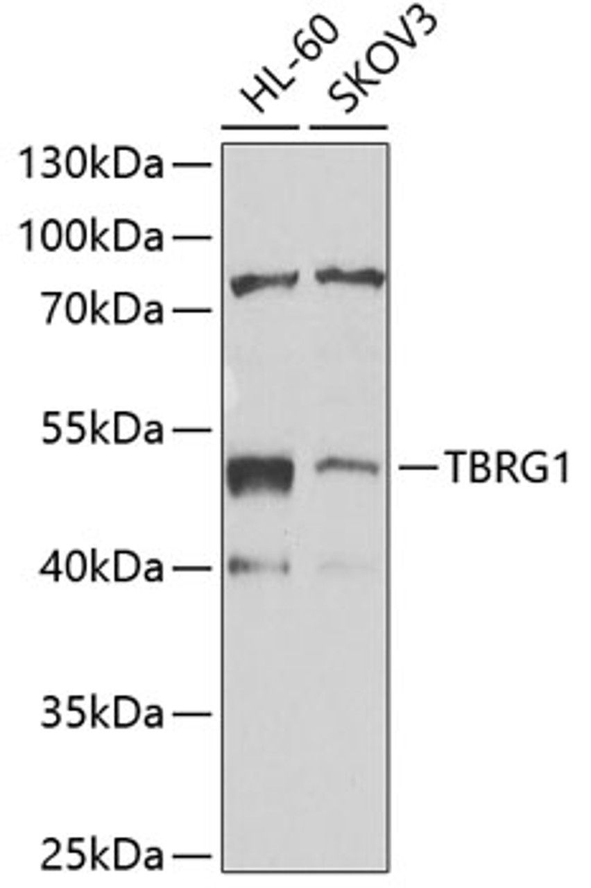 Western blot analysis of extracts of various cell lines, using TBRG1 antibody (22-751) at 1:1000 dilution.<br/>Secondary antibody: HRP Goat Anti-Rabbit IgG (H+L) at 1:10000 dilution.<br/>Lysates/proteins: 25ug per lane.<br/>Blocking buffer: 3% nonfat dry milk in TBST.<br/>Detection: ECL Enhanced Kit.<br/>Exposure time: 90s.