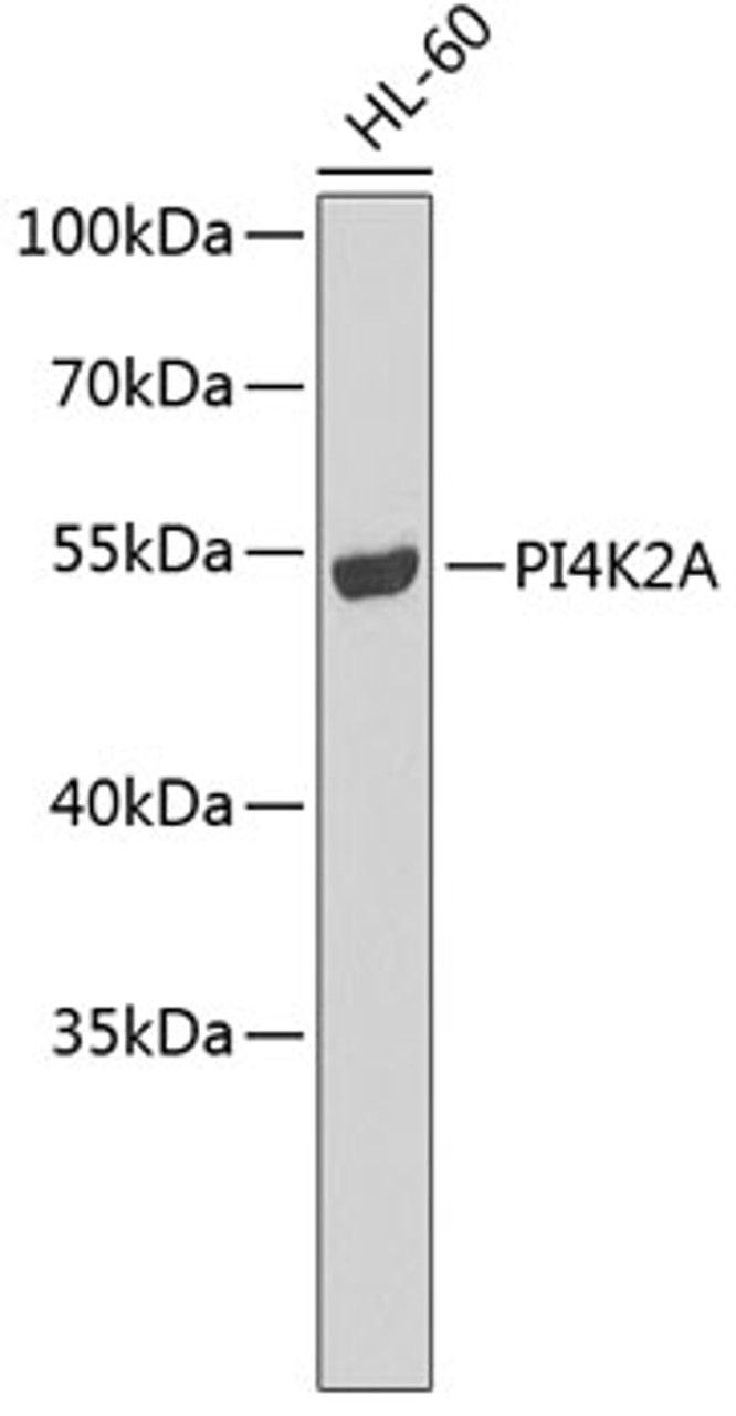 Western blot analysis of extracts of HL-60 cells, using PI4K2A antibody (22-754) .<br/>Secondary antibody: HRP Goat Anti-Rabbit IgG (H+L) at 1:10000 dilution.<br/>Lysates/proteins: 25ug per lane.<br/>Blocking buffer: 3% nonfat dry milk in TBST.