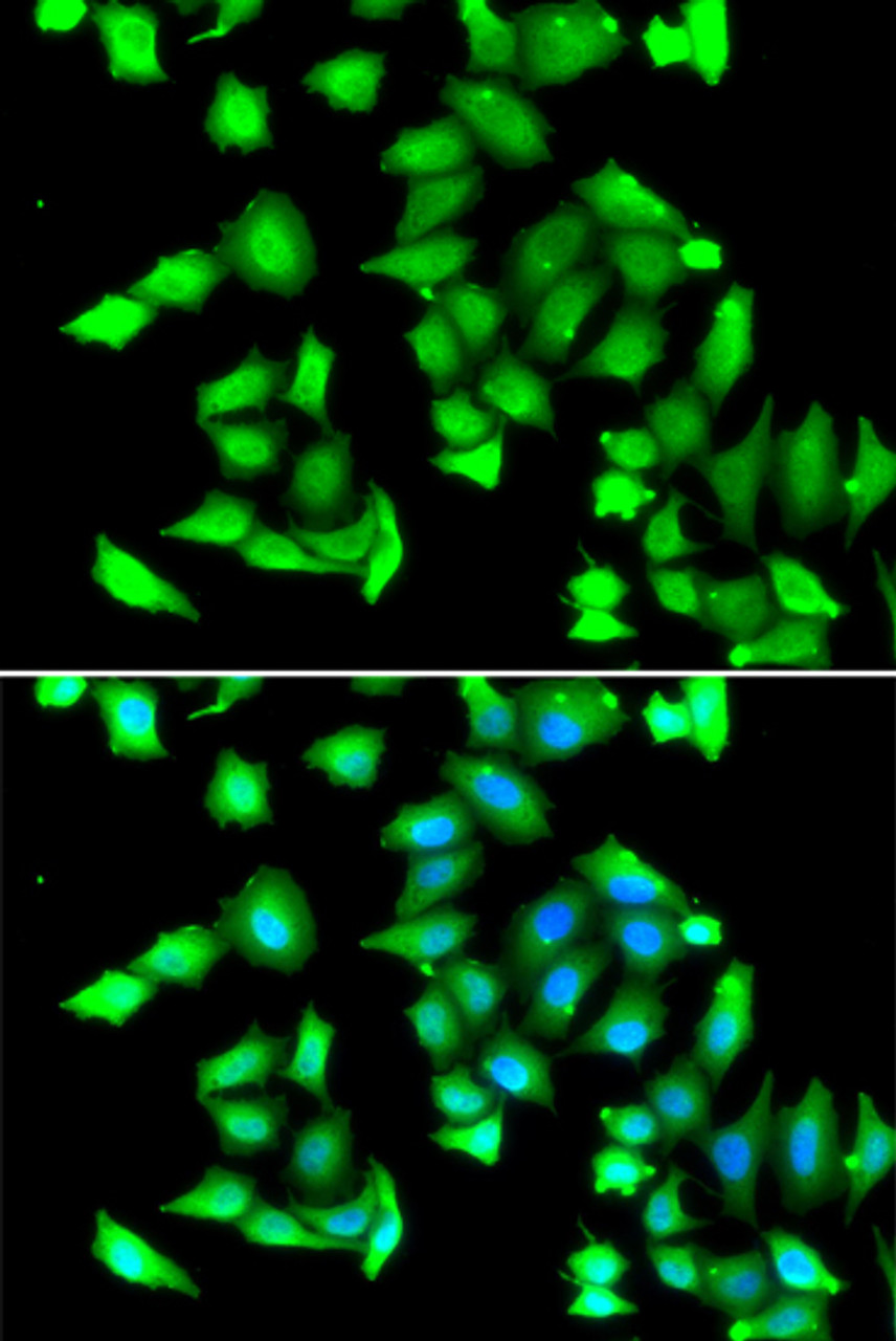 Immunofluorescence analysis of A549 cells using GSTCD antibody (22-767) . Blue: DAPI for nuclear staining.